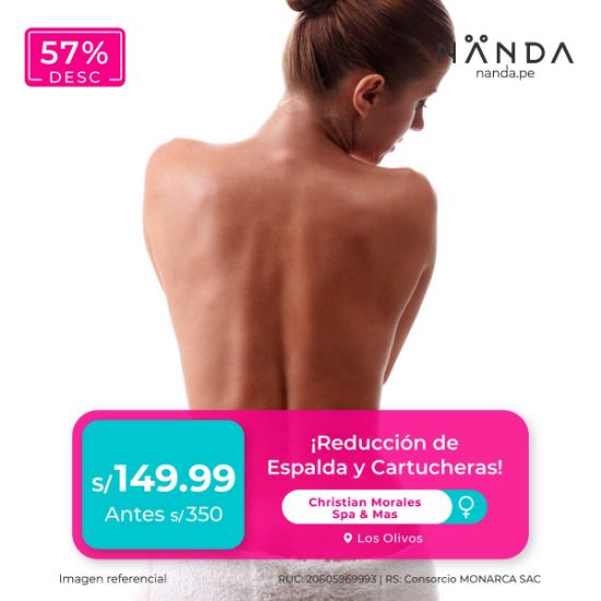 ¡Reducción de Espalda y Cartucheras! 😍- Christian Morales Spa & Mas (LOS OLIVOS)