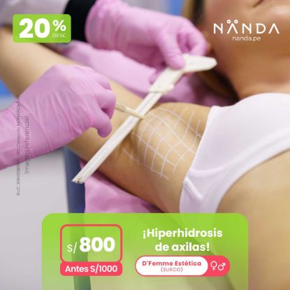 ¡Hiperhidrosis de axilas! 😍 - D'Femme Estética (SURCO)