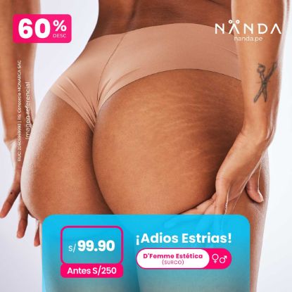 ¡Adiós Estrías! 😍 - D'Femme Estética (SURCO)