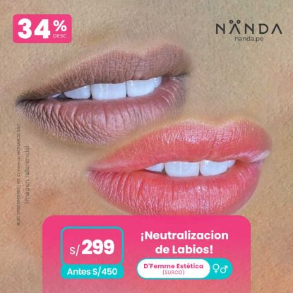 ¡Neutralización de Labios! 😍 - D'Femme Estética (SURCO)