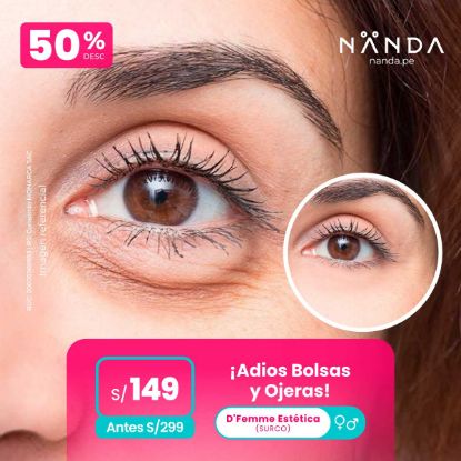¡Adiós Bolsas y Ojeras! 😍 - D'Femme Estética (SURCO)
