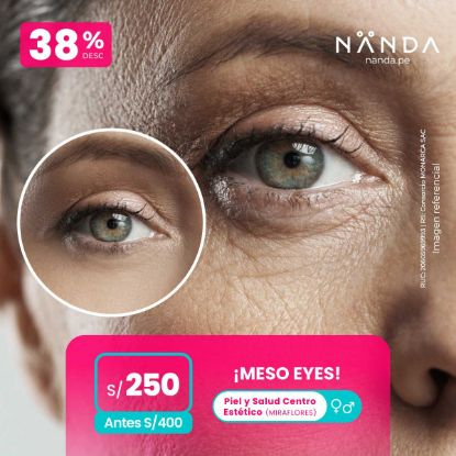 ¡MESO EYES! 😍 - Piel y Salud Centro Estético (MIRAFLORES)