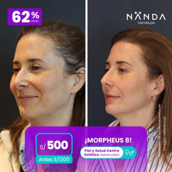 ¡MORPHEUS 8! 😍 - Piel y Salud Centro Estético (MIRAFLORES) 