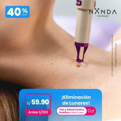 ¡Eliminación de Lunares! 😍 - Piel y Salud Centro Estético (MIRAFLORES)