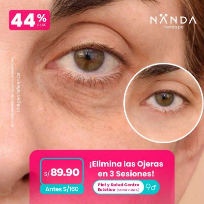 ¡Elimina las Ojeras en 3 Sesiones! 😍 - Piel y Salud Centro Estético (MIRAFLORES)