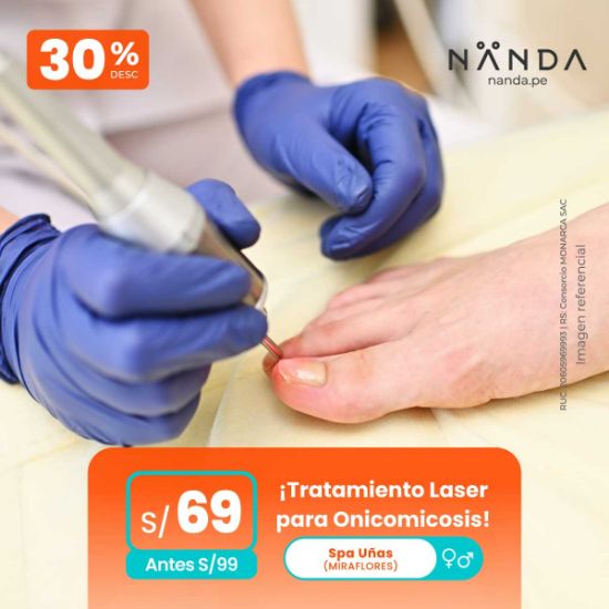 ¡Tratamiento Laser para Onicomicosis! 😍 - Spa Unas (CAMACHO)