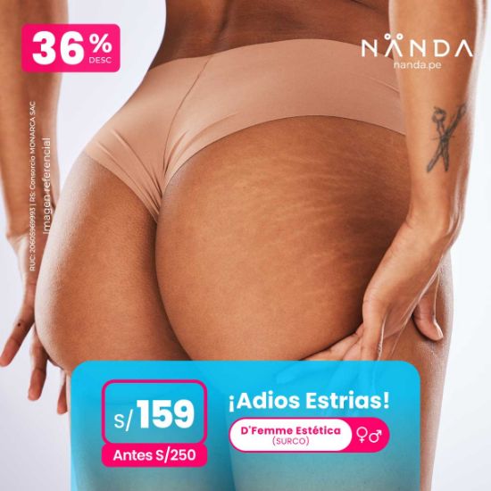 ¡Adiós Estrías! 😍 - D'Femme Estética (SURCO)