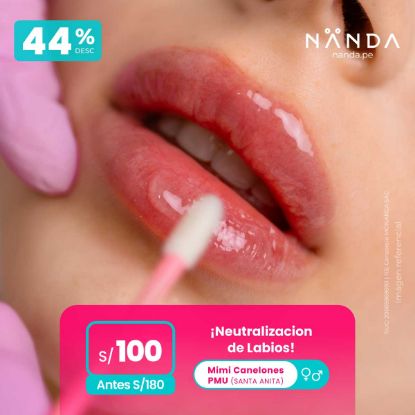 ¡Neutralización de Labios  😍 - Mimi Canelones PMU (SANTA ANITA)