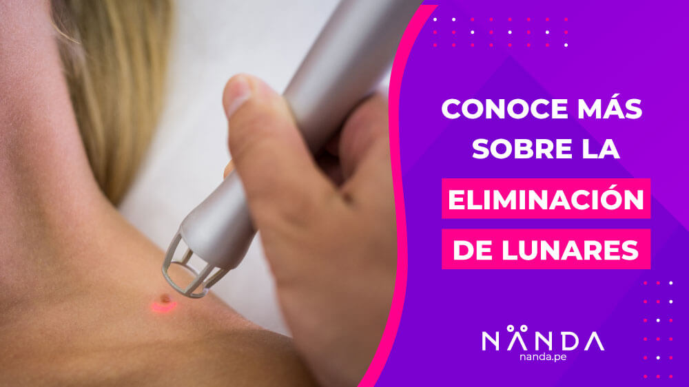 Conoce todo sobre la eliminación de lunares